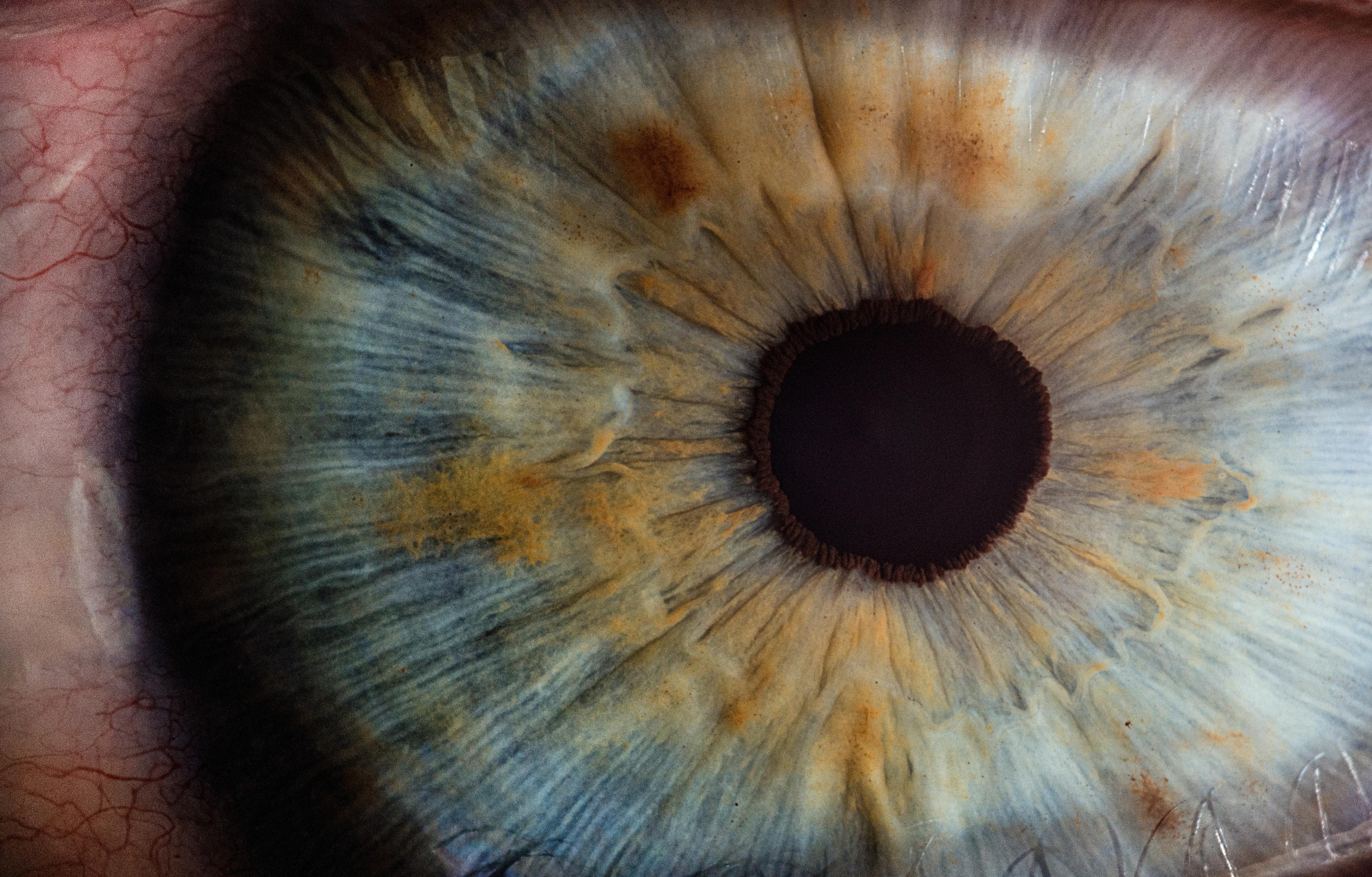 Przy jakich wadach wzroku może pomóc laserowa korekcja? 