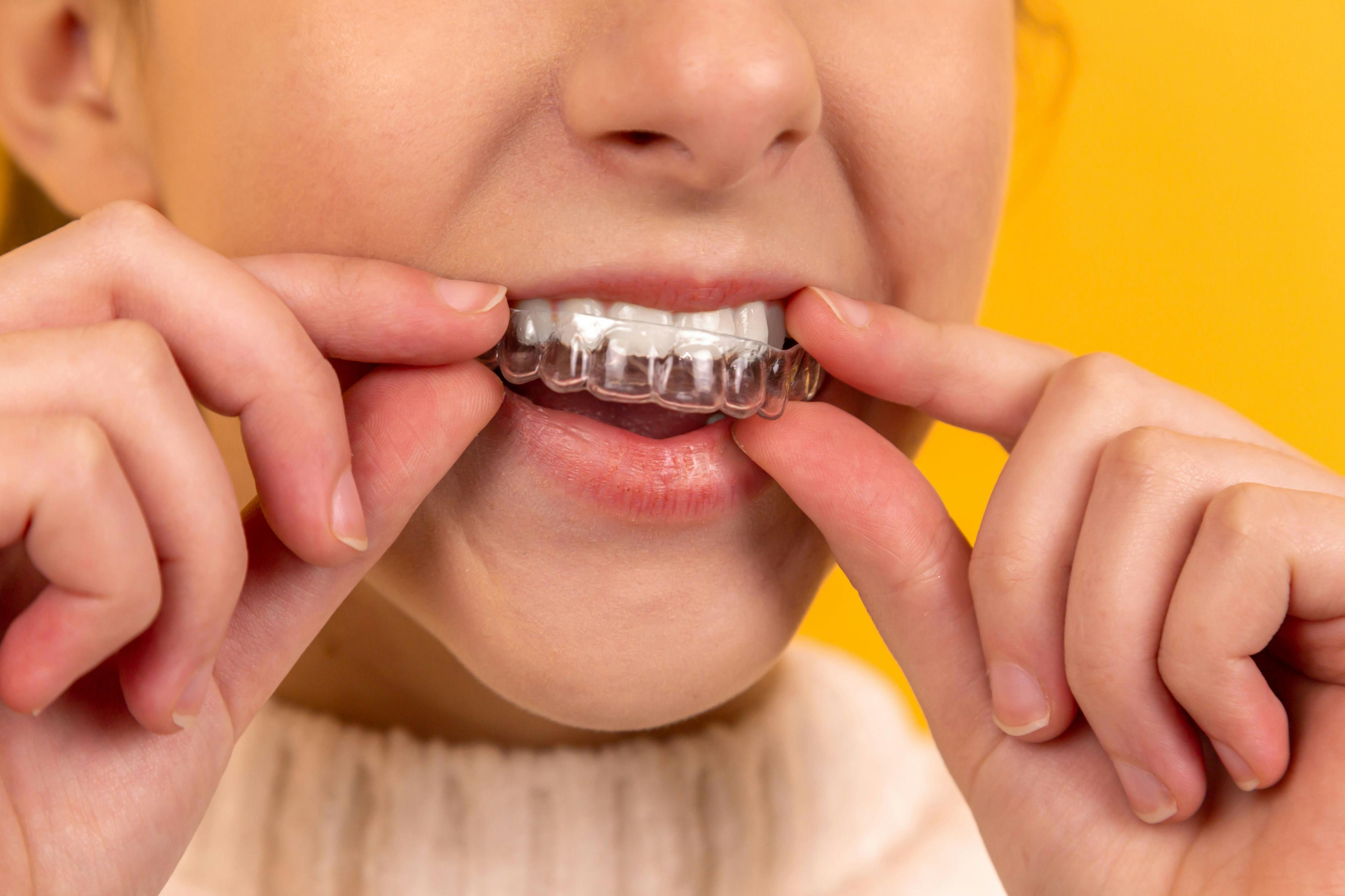 Jakie mogą być przyczyny zgrzytania zębami (bruksizmu)? 